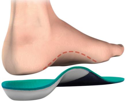 arch-supports-for-flat-feet